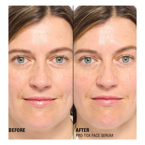 Revolution Pro - *Miracle Pro-Tox* - Siero viso riparatore e riempitivo delle rughe