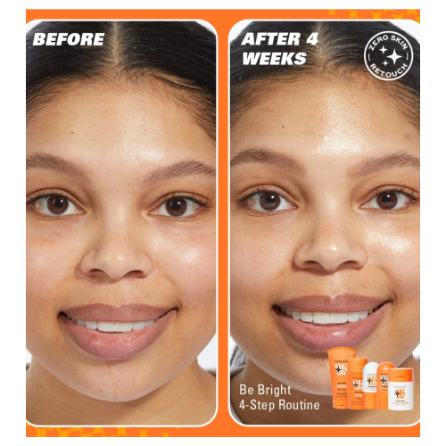 Revolution Skin - *Be Bright* - Siero viso illuminante con il 3% di vitamina C Brighten Up