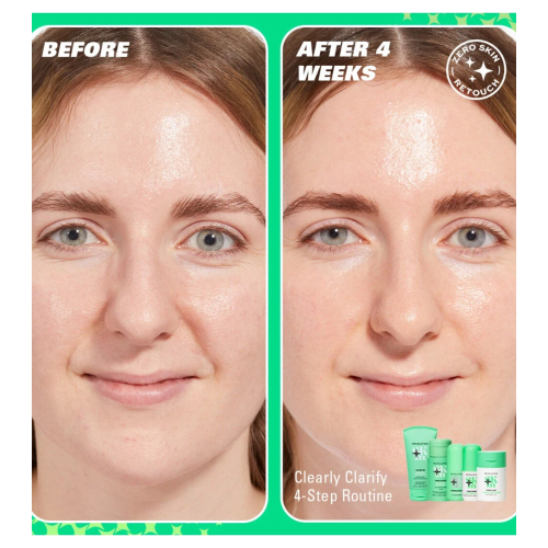 Revolution Skin - *Clearly Clarify* - Siero viso schiarente al 5% di niacinamide e al 2% di acido salicilico Clear Canvas