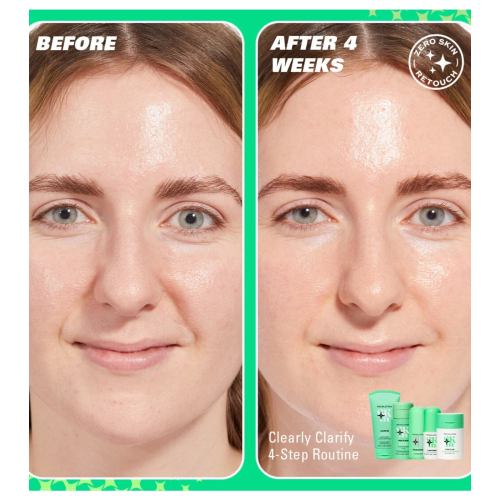 Revolution Skin - *Clearly Clarify* - Siero viso schiarente al 10% di niacinamide Serum Supreme