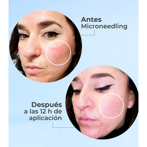 SEGLE - Siero viso rigenerante antietà Skin Factor - Pelle sensibile