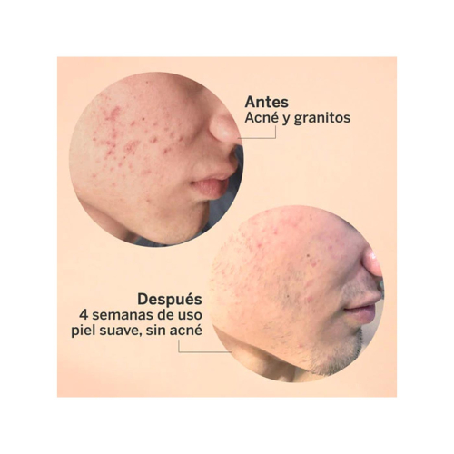 SEGLE - Siero viso esfoliante AHA/BHA