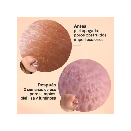 SEGLE - Siero viso esfoliante all'acido glicolico Glycolmix