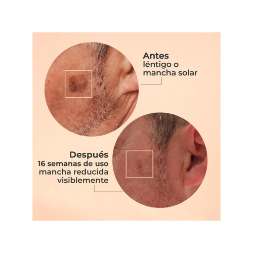 SEGLE - Siero viso esfoliante all'acido glicolico Glycolmix