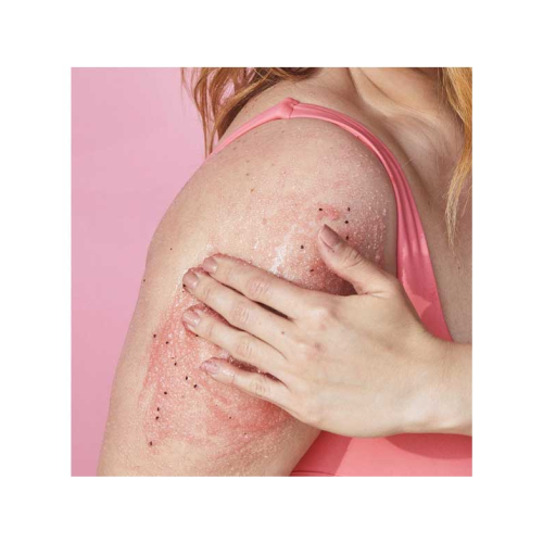 Tree Hut - Scrub per il corpo Shea Sugar Scrub - Watermelon