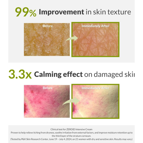 Zeroid - Crema intensiva riparatrice